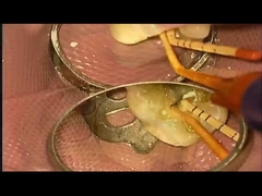 Υπόθεση SANI TREATMENT